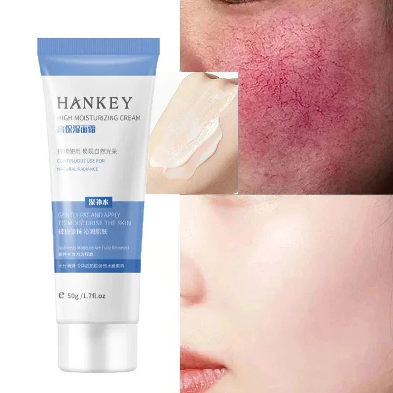 Facial Redness Repair Cream Improve Sensitive Skin Dryness Moisturizer Hydrating Sooth Lotion Removal Rosacea Korean Cosmetics