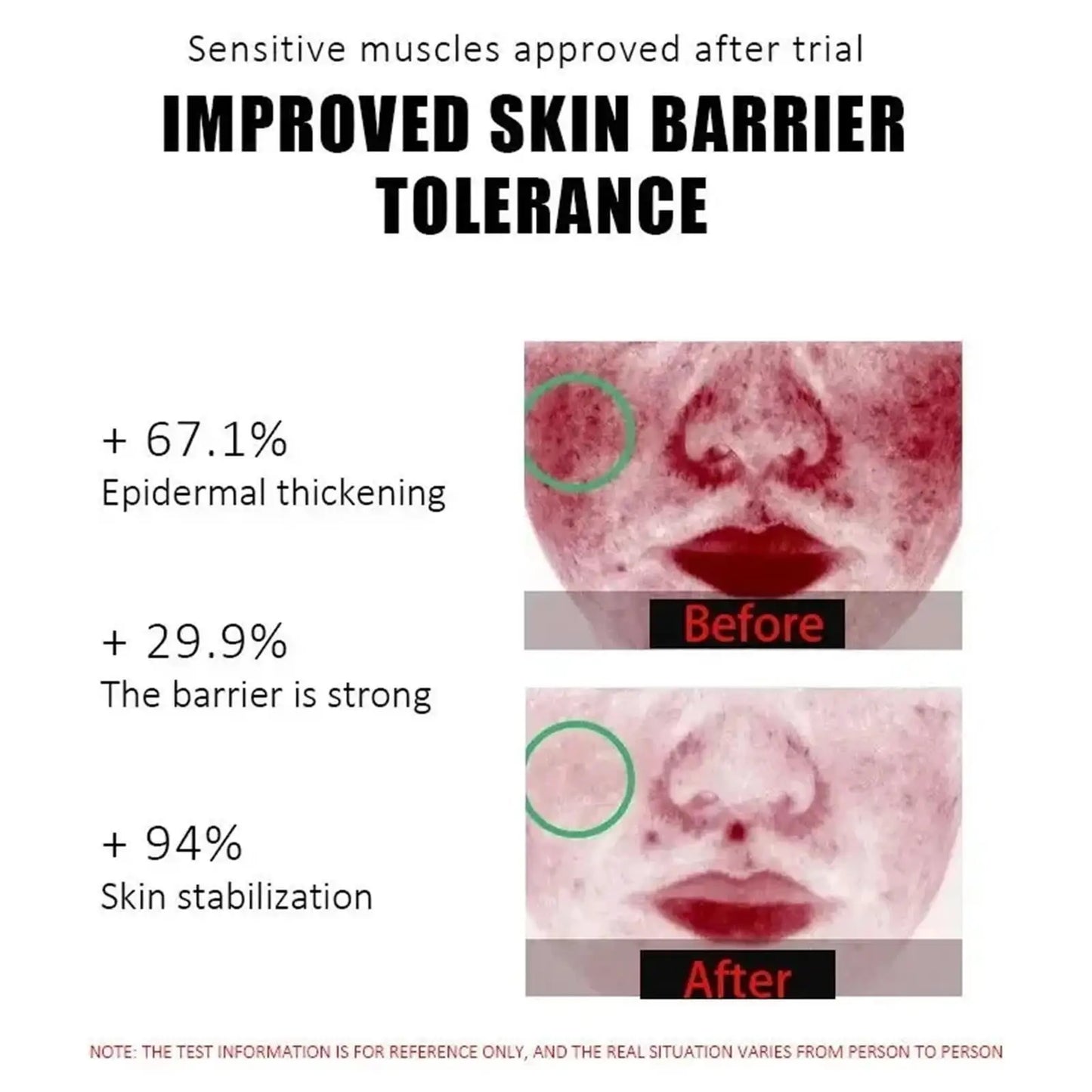 Facial Redness Repair Capsule Oil Improve Sensitive Skin Dryness Moisturizer Soothing Serum Removal Rosacea Korean Cosmetics