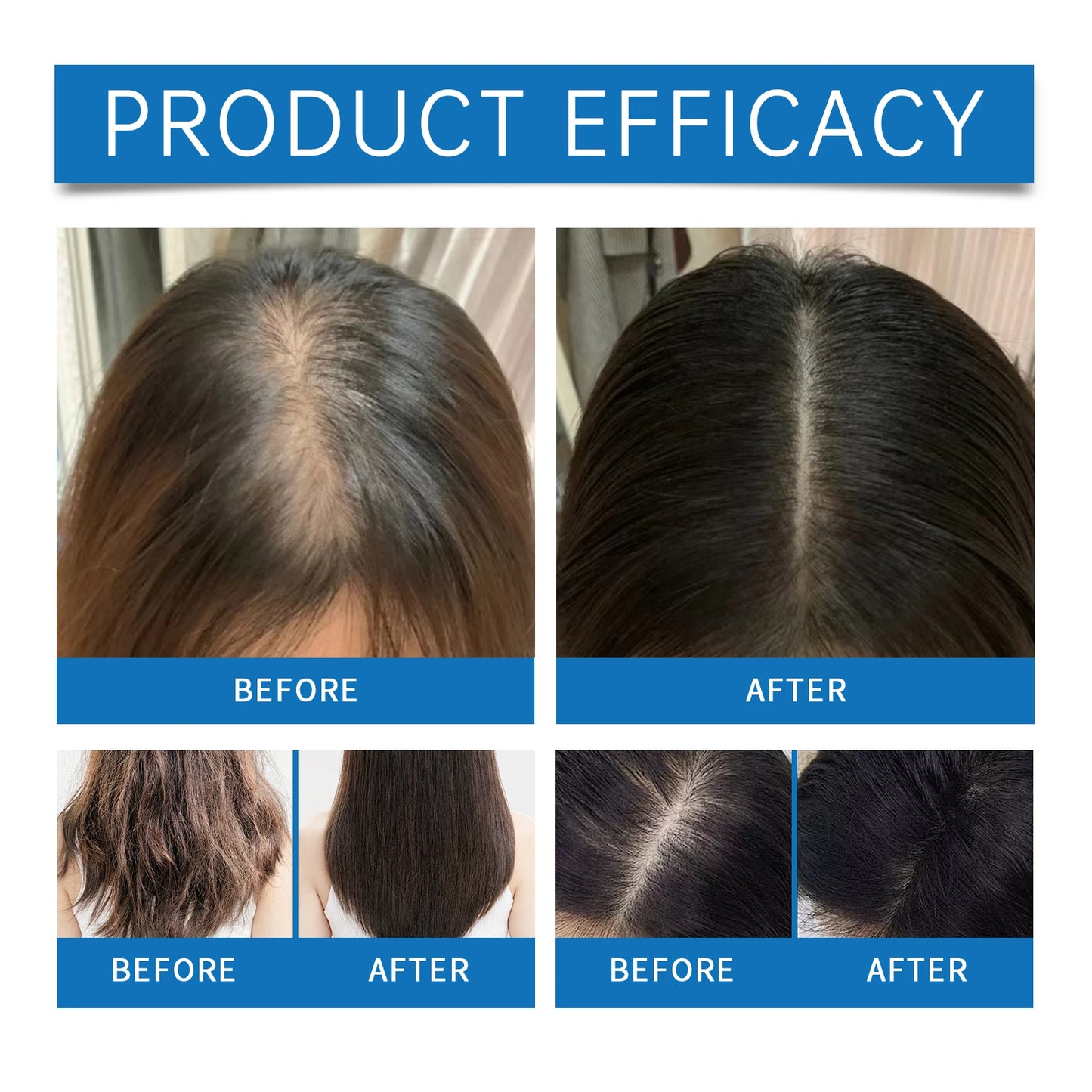 Ginger Hair Growth Oil Nourishing Strengthening Hair Roots Scalp Treatment Hair Loss Serum Moisturizing Hair Care Essence Roller