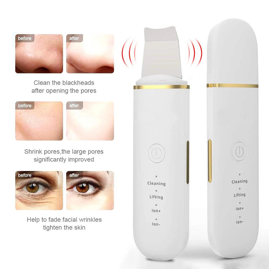 Ultrasonic skin scrub, facial skin cleansing, pore blackhead cleaning machine, and skincare tools for deep facial cleansing