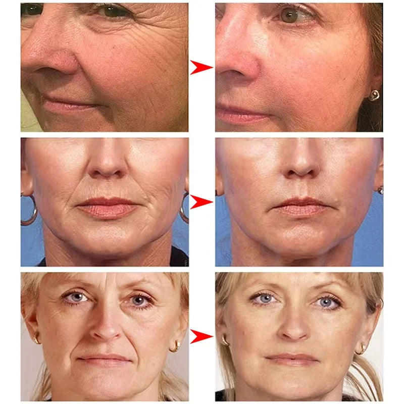 Collagen Wrinkle Remover Face Serum Firming Lift Anti Aging Fade Fine Lines Whitening Brighten Moisturizing Skin Care Cosmetics