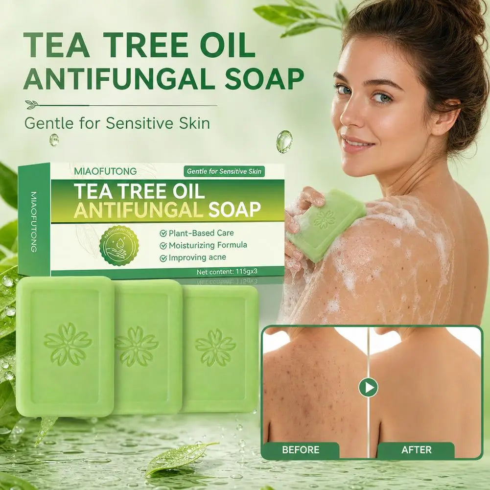 Tea Tree Soap for Face & Body Acne, 3pcs Tea Tree Oil Soap Bar for Face & Body Natural Skin Cleanser for Oily, Dry & Itchy Skin