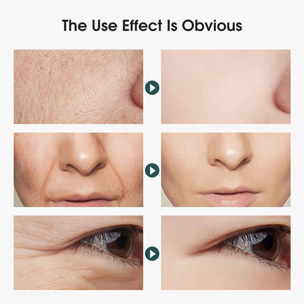 V Shape Face Lifting Skin Beauty Tools Device EMS Facial Machine Face Massager